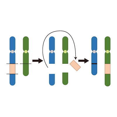 染色体の構造異常(挿入)