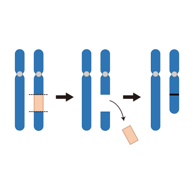 染色体の構造異常(中間部欠失)