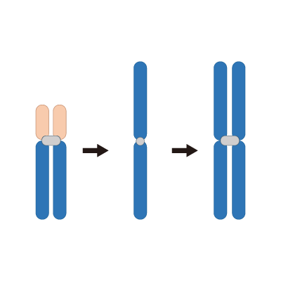 染色体の構造異常(同腕染色体)