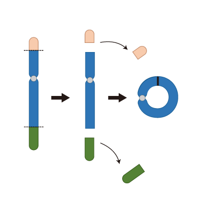染色体の構造異常(環状染色体)