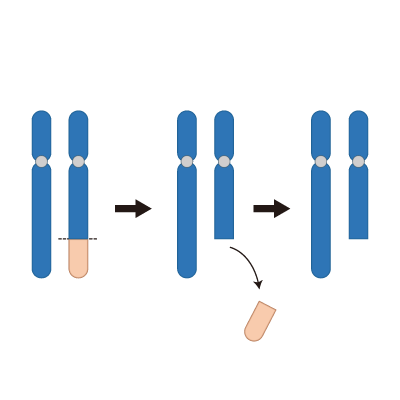 染色体の構造異常(端部欠失)